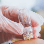 Aqua Gold is a microneedling treatment – 39,500 LKR