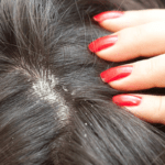 Herbal Anti Dandruff treatment – 11,500LKR (2)