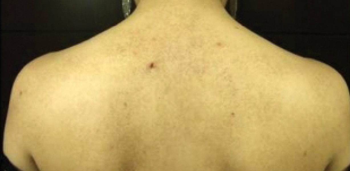 Before